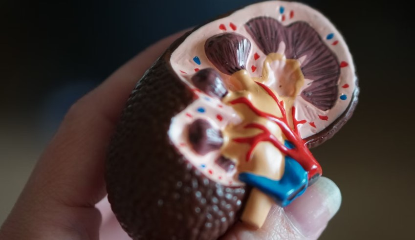 Hospital In California For Kidney Stone Treatment.jpg